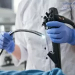 آندوسکوپی معده