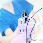 بعد از آندوسکوپی معده چه بخوریم؟