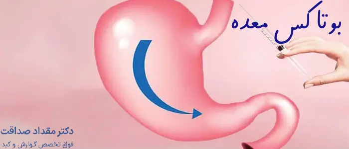 بوتاکس معده بهتر است یا بالن؟