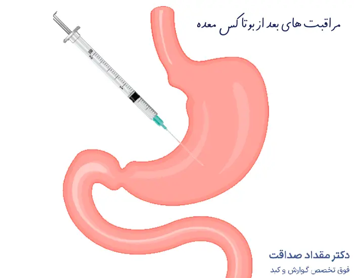 مراقبت های بعد از بوتاکس معده