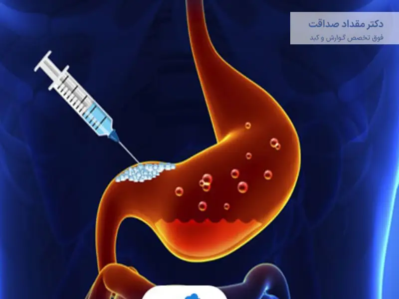 مراقبت های بعد از بوتاکس معده