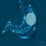 بالن معده
