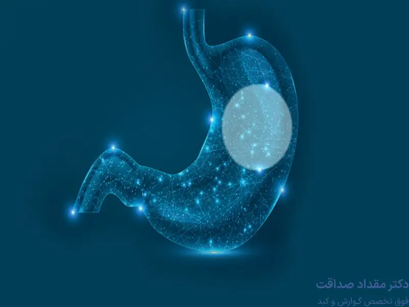 بالن معده