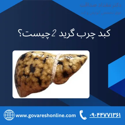 کبد چرب گرید 2؛ راهنمای جامع