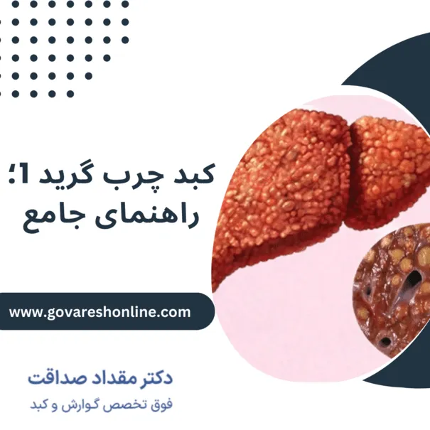کبد چرب گرید 1؛ راهنمای جامع