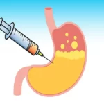 عوارض بوتاکس معده