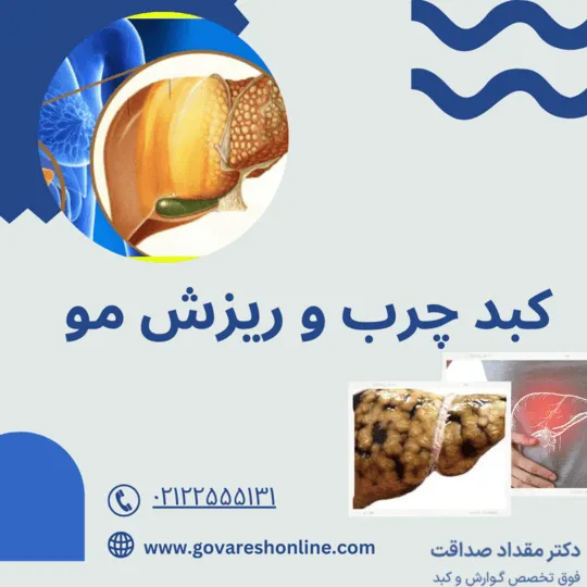 ارتباط بین “کبد چرب و ریزش مو” چیست؟