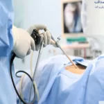 عوارض بعد از آندوسکوپی معده