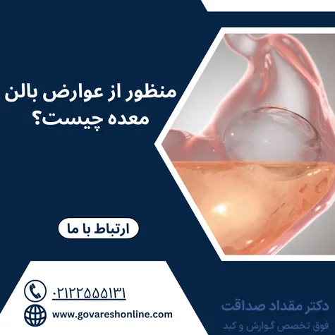 عوارض بالن معده؛ نکات مهم