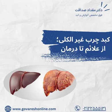کبد چرب غیر الکلی؛ از علائم تا درمان
