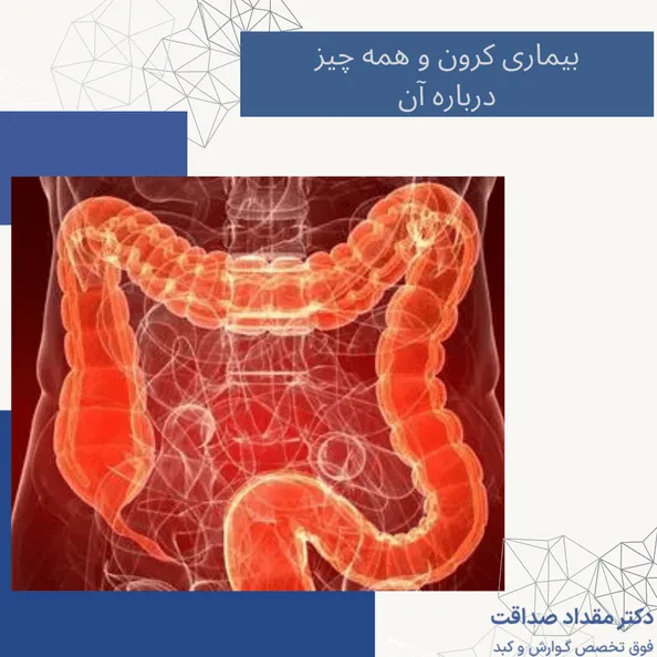 بیماری کرون و همه چیز درباره آن
