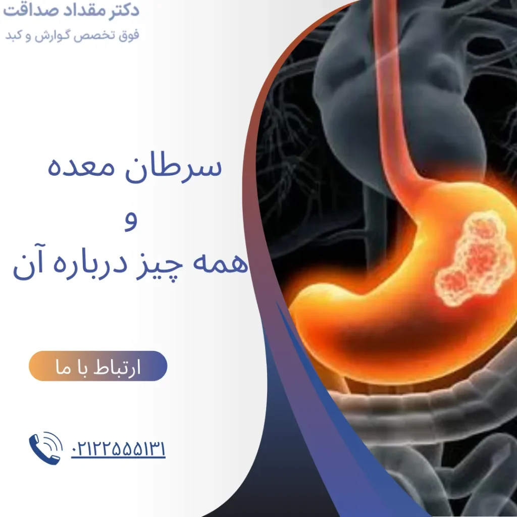 سرطان معده و همه چیز درباره آن