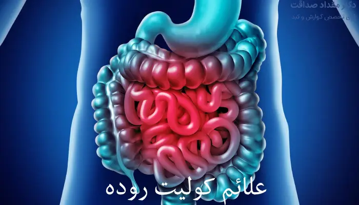 کولیت روده؛ از علائم تا درمان
