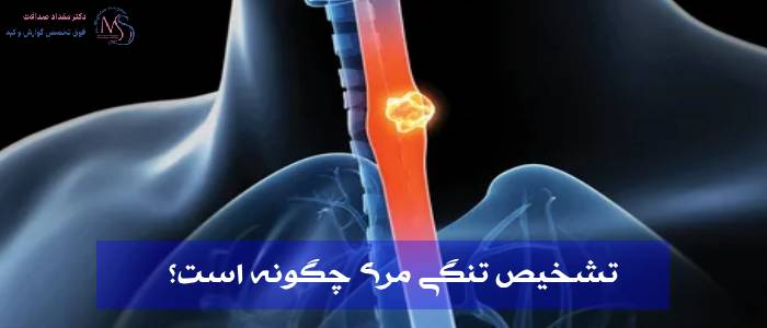 تنگی مری؛ علائم + تشخیص و پیشگیری