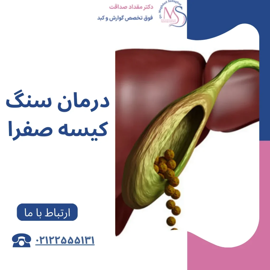 درمان سنگ کیسه صفرا با روش های نوین