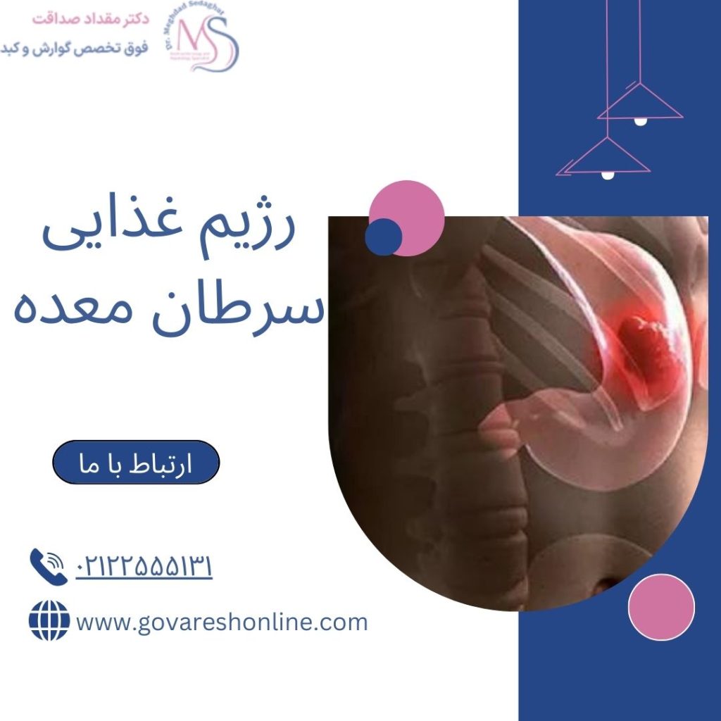 رژیم غذایی سرطان معده؛ نکات مهم