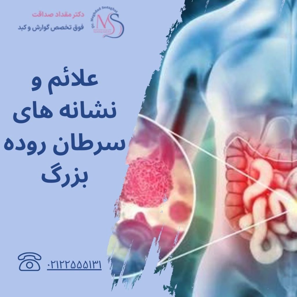 سرطان روده بزرگ؛ علت و علائم + تشخیص
