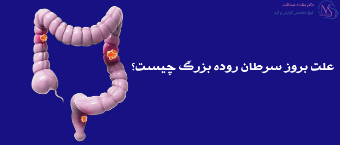 سرطان روده بزرگ؛ علت و علائم + تشخیص