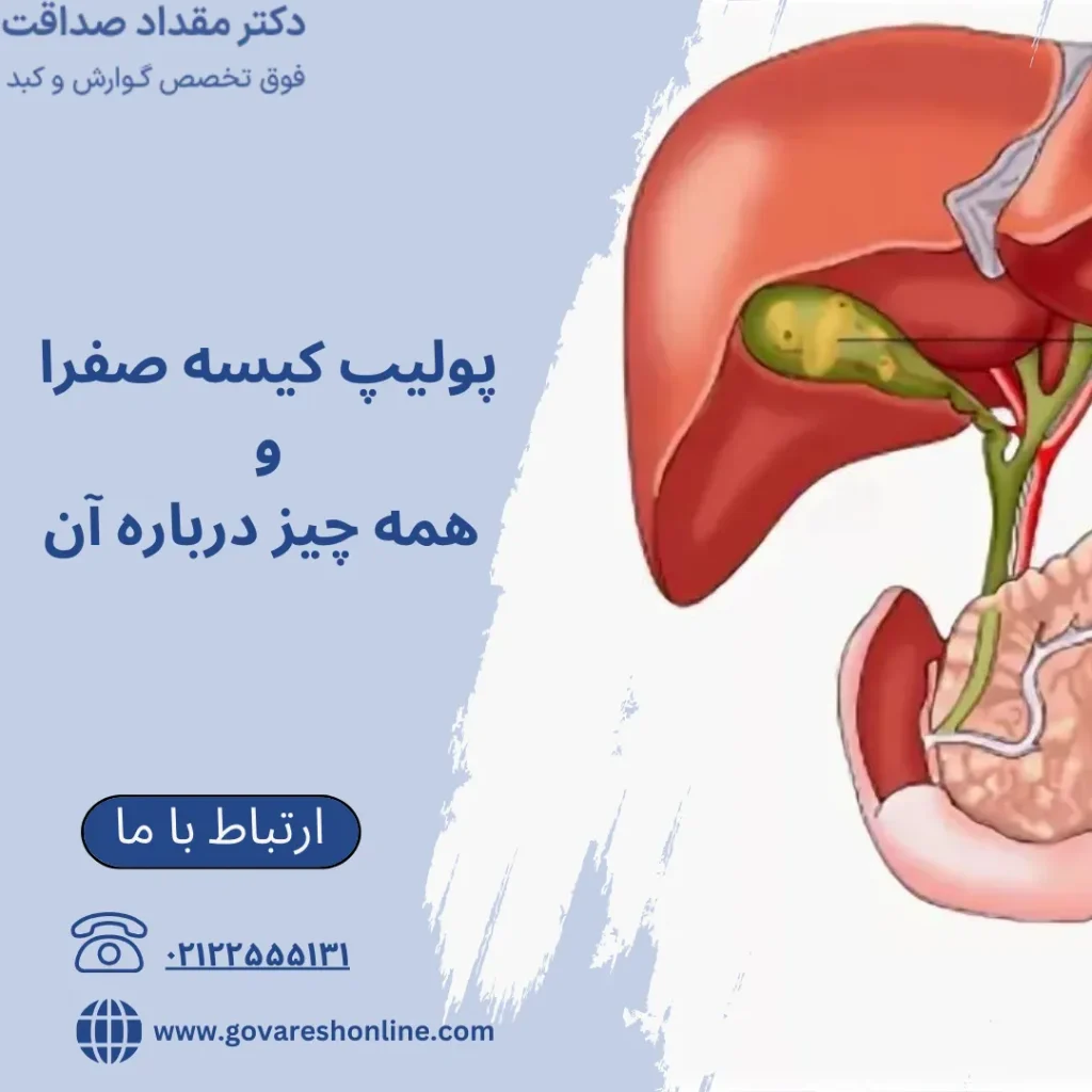 پولیپ کیسه صفرا و همه چیز درباره آن