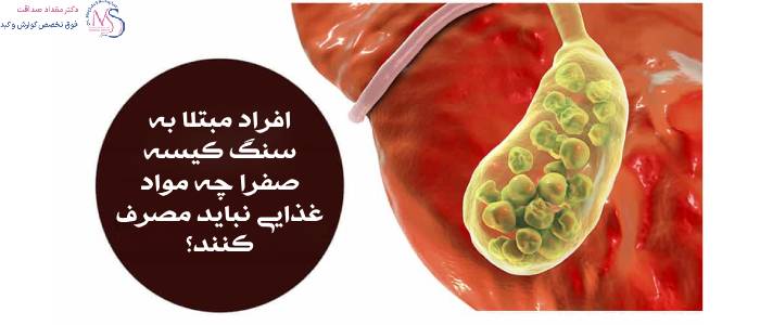 رژیم غذایی مناسب برای دفع سنگ کیسه صفرا