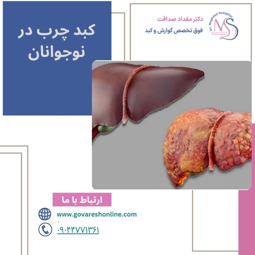 کبد چرب در نوجوانان؛ راهنمای جامع
