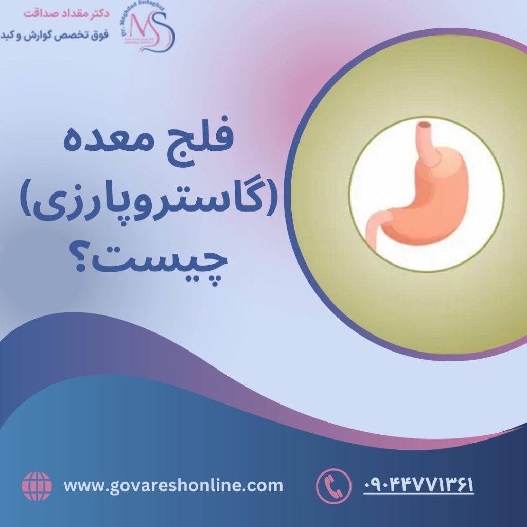 فلج معده؛ علائم، تشخیص و درمان آن