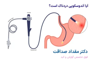 آندوسکوپی