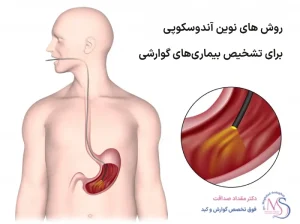آندوسکوپی