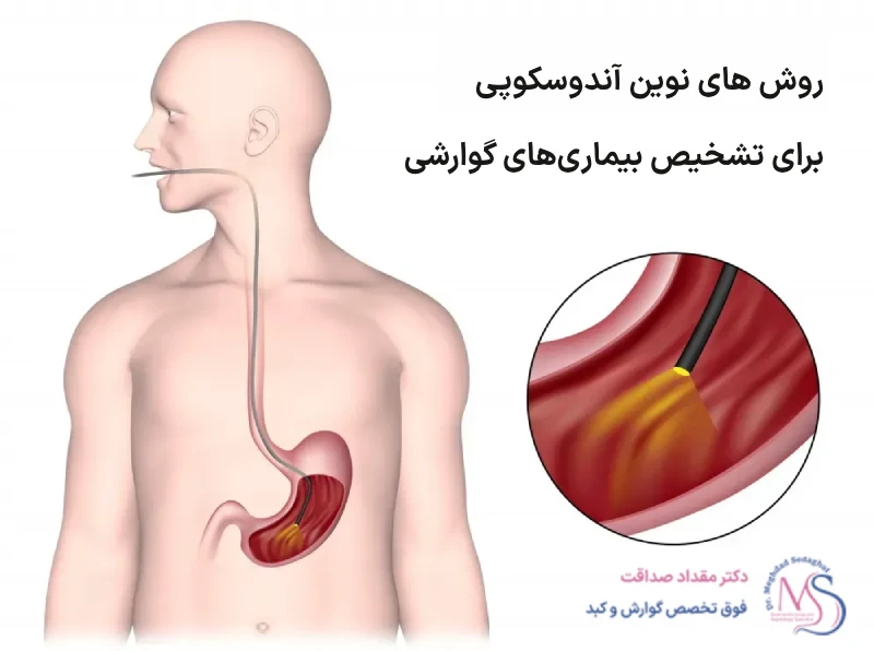 مقالات