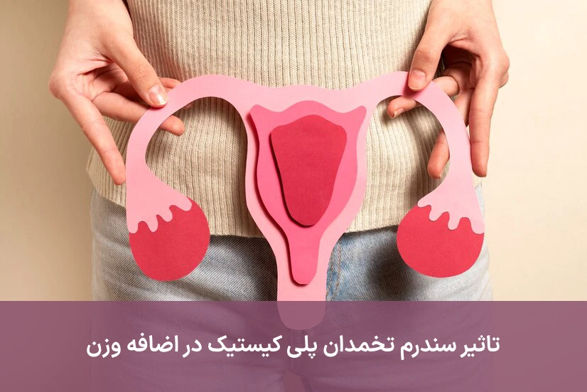 تاثیر سندرم تخمدان پلی‌ کیستیک (PCOS) در اضافه وزن یا چاقی