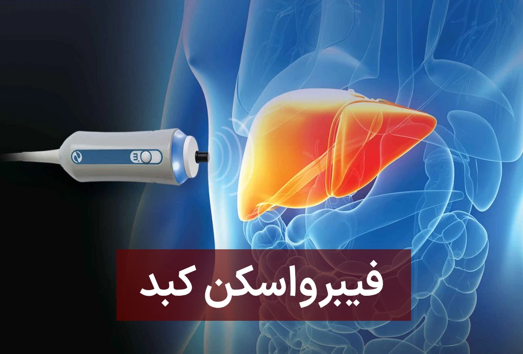 فیبرواسکن کبد چیست؟