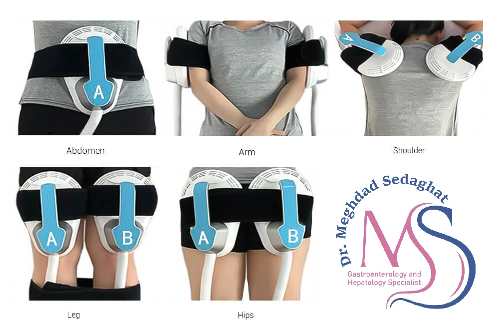 لاغری و عضله‌ سازی با دستگاه EMS