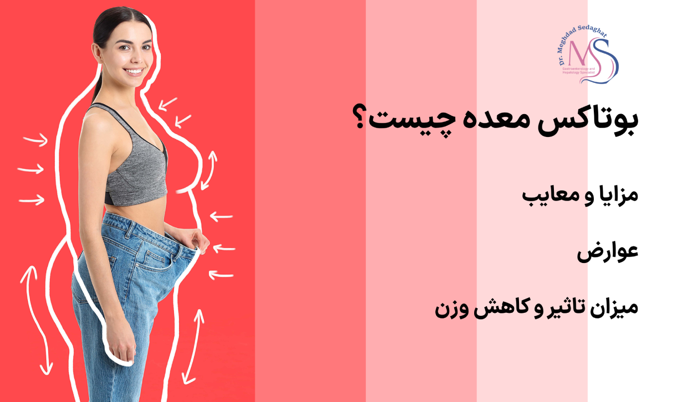 بوتاکس معده چیست؟