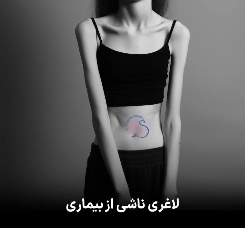 تفاوت لاغری ژنتیکی با لاغری بیماری‌ زا