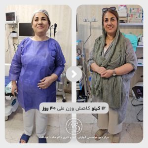 بوتاکس معده