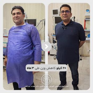 بوتاکس معده