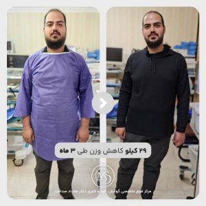 بوتاکس معده