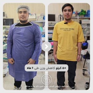 بوتاکس معده